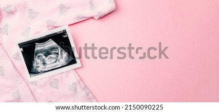 Ultrasound picture pregnant baby photo. Fashion cute baby cloth with ultrasound pregnancy image on pink background. Pregnancy, medicine, pharmaceutics, health care and people concept
