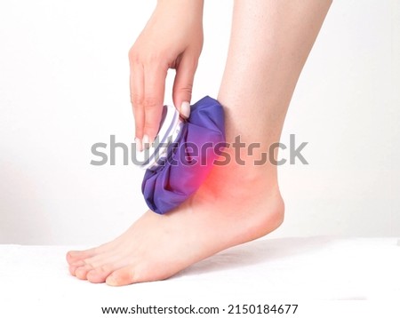 A girl applies a medical blue ice pack to the ankle joint to relieve pain and relieve swelling. Treatment of sports injuries and arthrosis of the leg joint, rheumatoid arthritis Royalty-Free Stock Photo #2150184677
