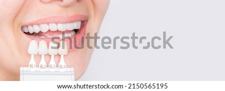 Banner tooth whitening, perfect white crown teeth close up with shade guide bleach color, female veneer smile, dental care and stomatology, dentistry, copyspace. Royalty-Free Stock Photo #2150565195