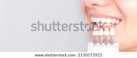 Banner tooth whitening, perfect white crown teeth close up with shade guide bleach color, female veneer smile, dental care and stomatology, dentistry, copyspace. Royalty-Free Stock Photo #2150573923