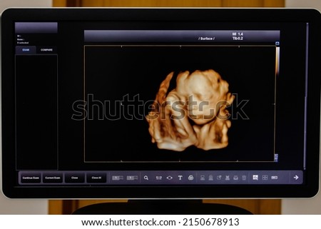 image Ultrasound 3D or 4D of baby in mother's womb. Picture 4D with Ultrasound of baby in mother's womb show the face. Royalty-Free Stock Photo #2150678913