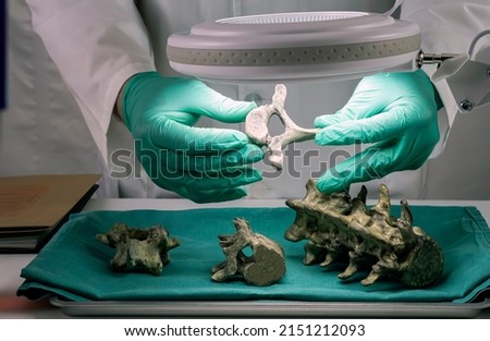 Forensic scientist examines victim's vertebrae to extract DNA, forensic lab, conceptual image Royalty-Free Stock Photo #2151212093
