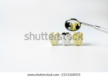 Decay and yellow tooth with black cavity and plaque reflect on mirror mouth on white background            