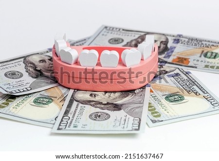 Jaw model with dollar bills. Teeth insurance and cost of tooth treatment, implantation, extraction concept. Money in stomatology. High quality photo