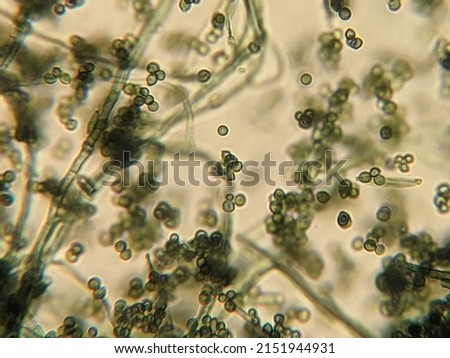 photo of fungi hyphae with spores under the microscope Royalty-Free Stock Photo #2151944931