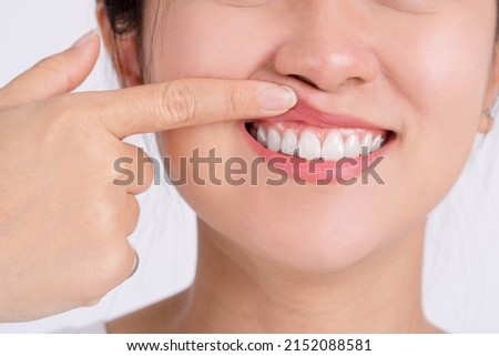 Woman showing her upper gums with her finger, an expression of pain. Dental care and toothache. Royalty-Free Stock Photo #2152088581