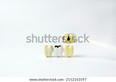 Yellow plaque tooth with black cavity reflect on mirror mouth on white background                                                 