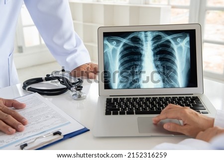 doctor diagnose lung x-ray image on digital tablet screen with radiologic technologist team. Royalty-Free Stock Photo #2152316259
