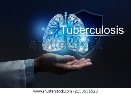 Medical banner Tuberculosis on blue background with large copy space for text or checklist.