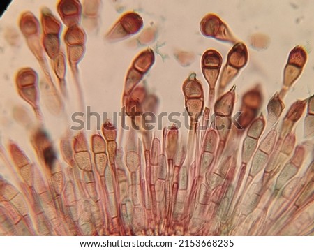 photo under microscope of fungi growth on the plant cells Royalty-Free Stock Photo #2153668235