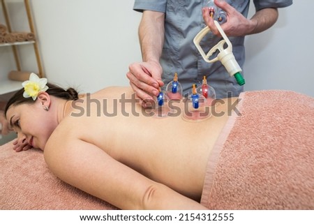 male therapist giving treatment with cupping on the back. The masseur puts cans on the back of a young girl Royalty-Free Stock Photo #2154312555