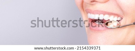 Banner perfect white teeth veneer smile with dental mirror close up, female winner smile, dental care and stomatology, dentistry, copyspace Royalty-Free Stock Photo #2154339371