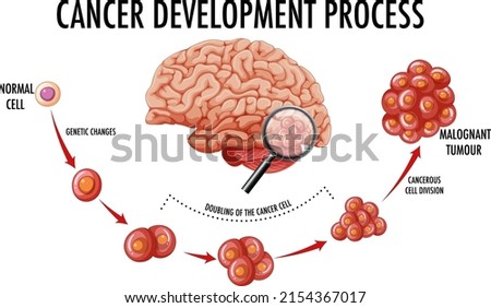 Diagram showing cancer development process illustration