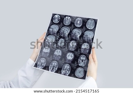 MRI of the brain. Neuropathologist holds a picture against the background of a light device to see pathologies and injuries brain. Diagnosis and treatment of neuralgia, epilepsy and other pathologies