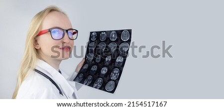 MRI of the brain. Neuropathologist holds a picture against the background of a light device to see pathologies and injuries brain. Diagnosis and treatment of neuralgia, epilepsy and other pathologies