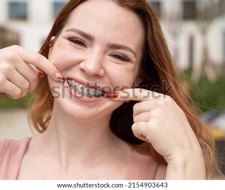 Young red-haired woman with braces on her teeth point to a smile outdoors in summer