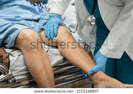 Asian senior or elderly old lady woman patient show her scars surgical total knee joint replacement Suture wound surgery arthroplasty on bed in nursing hospital ward, healthy strong medical concept. Royalty-Free Stock Photo #2155168807