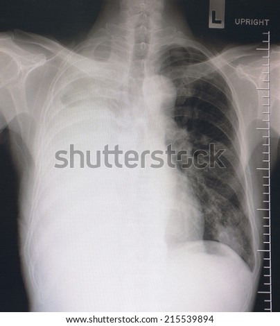 X ray image of a human body on the computer monitor