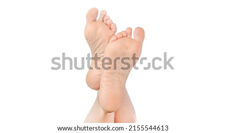 rough skin on soles of feet. dry heels, dry chapped skin on feet requiring care. Dry and cracked soles of feet. female legs in an elegant position isolated on white background, copy space Royalty-Free Stock Photo #2155544613