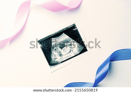 Ultrasound picture pregnant baby photo. Blue, pink ribbon with ultrasound pregnancy image on white background. Pregnancy, medicine, pharmaceutics, health care and people concept