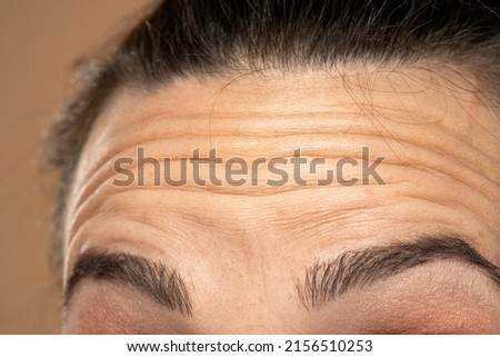 Close up of forehead with wrinkles of young woman. Royalty-Free Stock Photo #2156510253