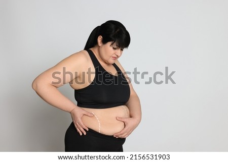 Obese woman with marks on body against light background, space for text. Weight loss surgery Royalty-Free Stock Photo #2156531903