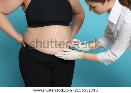 Doctor drawing marks on obese woman's body against light blue background, closeup. Weight loss surgery Royalty-Free Stock Photo #2156531913