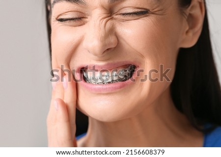 Beautiful woman with dental braces having pain in clinic, closeup Royalty-Free Stock Photo #2156608379