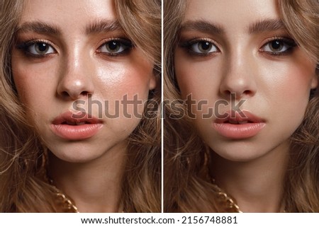 close-up girl with hyperhidrosis on her face and excessive oily sheen, with enlarged pores and bad tone. before and after treatment with botulinum toxin injections and cosmetological therapy Royalty-Free Stock Photo #2156748881