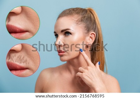 Portrait of a young Caucasian woman pointing to a mustache above her upper lip. The result before and after the epilation procedure. Blue background. The concept of hair removal. Royalty-Free Stock Photo #2156768595