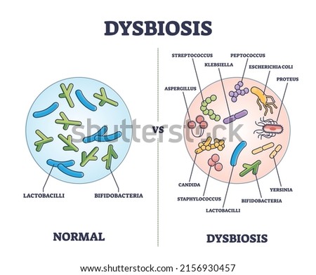 Dysbiosis versus normal gut or tract microflora with bacteria outline diagram. Labeled educational scheme with digestive system differences vector illustration. Microscopic microbe flora comparison. Royalty-Free Stock Photo #2156930457