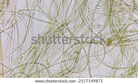 Cyanobacteria called Nostoc sp. collected from wetland. 400x microscope magnification + 2x camera zoom Royalty-Free Stock Photo #2157149875