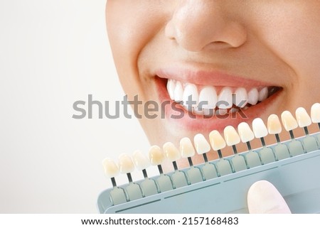 Smile of a young woman. Cosmetological teeth whitening in a dental clinic. selection of the tone of the implant tooth Royalty-Free Stock Photo #2157168483