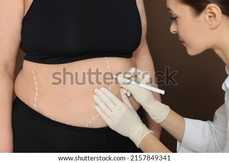 Doctor drawing marks on obese woman's body against brown background, closeup. Weight loss surgery Royalty-Free Stock Photo #2157849341