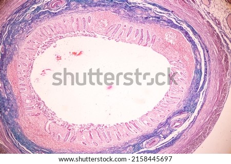Tissue of Small intestine (Duodenum) and Vermiform appendix  Human under the microscope in Lab. Royalty-Free Stock Photo #2158445697