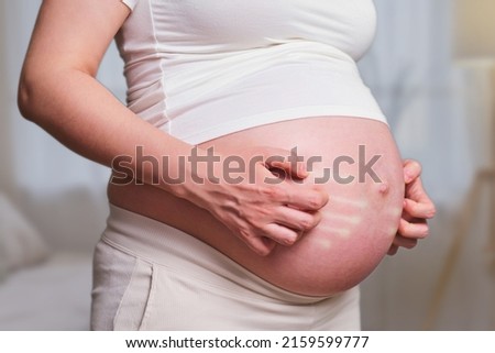 Hands of a pregnant woman scratching her stomach, home living room Royalty-Free Stock Photo #2159599777