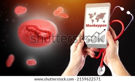Monkeypox virus strain. Graph growth monkeypox infections in phone. Doctor hands with stethoscope on dark. Molecule is infected with fever. Monkeypox epidemic. Infectious virus outbreak.  Royalty-Free Stock Photo #2159622571