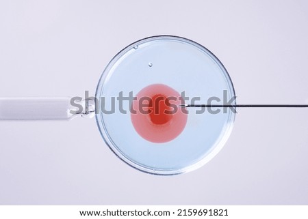 In vitro fertilisation concept. Artificial insemination or fertility treatment macro photography.  Royalty-Free Stock Photo #2159691821