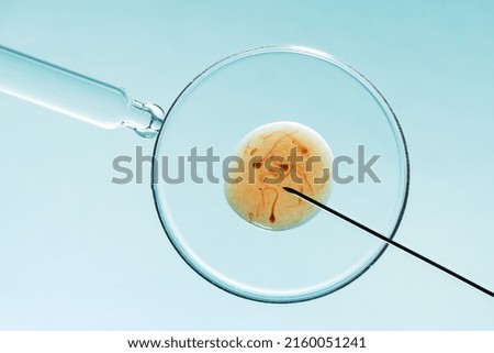 In vitro fertilisation concept. Artificial insemination or fertility treatment macro photography.  Royalty-Free Stock Photo #2160051241