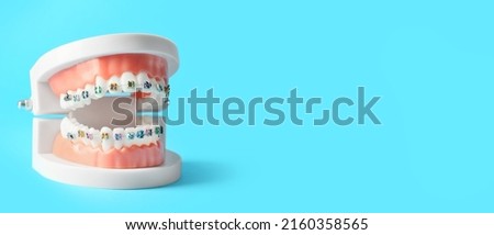 Model of jaw with braces on blue background with space for text