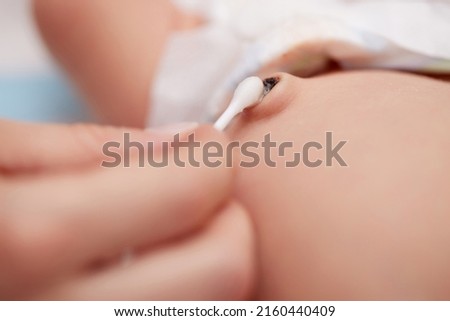 Treatment of newborn baby navel with cotton swab Royalty-Free Stock Photo #2160440409