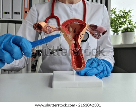 Hand of gynecologist doctor in glove holds out scalpel to female reproductive system. Surgery to remove the uterus Royalty-Free Stock Photo #2161042301