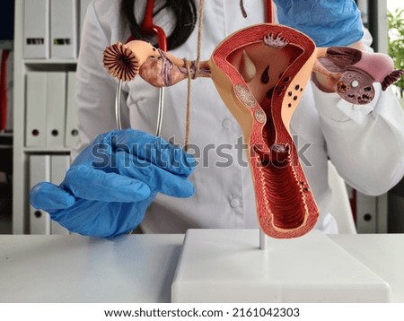 Gynecologist ligates fallopian tubes using model of the female reproductive system as example. Contraception for unwanted pregnancy Royalty-Free Stock Photo #2161042303