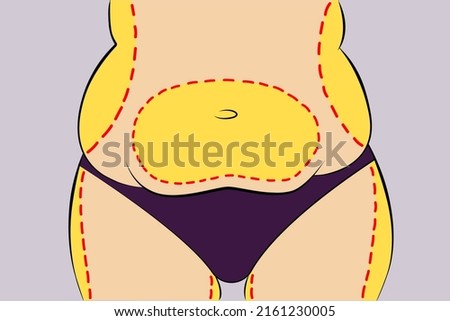 Woman fat belly with dotted line. Vector illustration. Weight and health problem concept. Royalty-Free Stock Photo #2161230005