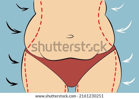 Woman fat belly with dotted line. Vector illustration. Weight and health problem concept. Royalty-Free Stock Photo #2161230251