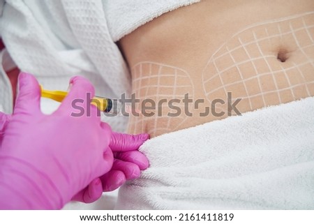 Dermatologist performing non invasive fat reduction procedure in beauty center Royalty-Free Stock Photo #2161411819