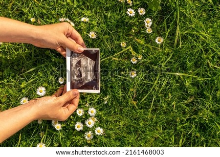 Ultrasound picture pregnant baby photo. Woman holding ultrasound pregnancy image on grass flower background. Concept of pregnancy, maternity, expectation for baby birth