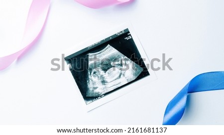Ultrasound picture pregnant baby photo. Blue, pink ribbon with ultrasound pregnancy image on white background. Pregnancy, medicine, pharmaceutics, health care and people concept Royalty-Free Stock Photo #2161681137