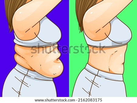 A woman's body with belly fat. Before, after. Healthcare illustration. Vector illustration. Royalty-Free Stock Photo #2162083175