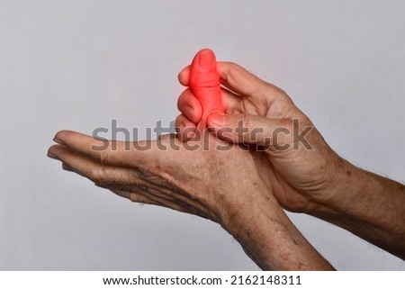 Inflammation of Asian old man thumb and hand. Concept of cellulitis, rheumatism and finger problems.